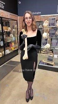 Rider’s bone: exostosis