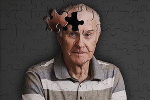 Navigating life with Alzheimer's: Tips for patients and caregivers