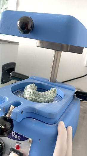 Essix Retainer diberikan kepada patient setelah selesai rawatan braces. 栗‍♀️ #seo #fyp #dentist #dentistaentiktok #dentistkl #dentistselangor #klinikgigikualalumpur #klinikpergigianerfacheras #klinikpergigianerfamelawati #dentistmalaysia #klinikgiginearme #retainerbraces #retainer | Klinik Pergigian Erfa | Facebook