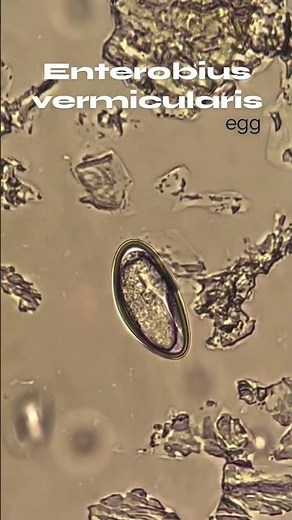 Enterobious vermicularis | Pin worm | Egg | Ova | parasite #lab #medlab #clinical #biology