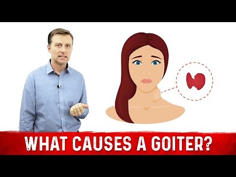 What Causes a Goiter? Causes of Thyroid Enlargement – Dr.Berg