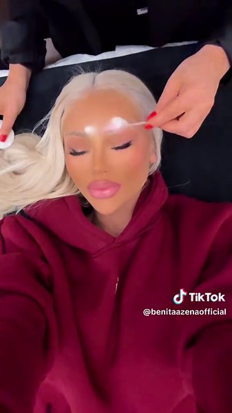 Effective Laser Tattoo Removal Techniques Explained