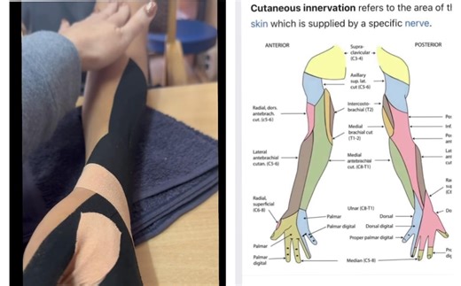 14K views · 148 reactions | Sometimes you just have to go higher up in the humerus to activate the muscles. A lot of the sensory nerves in the forearm exit in the humerus. “ Sensory leads motor” to quote my good friend Elizabeth Geiger Harvey. Just find out where to cue the sensory nerve to help improve motor function. #walkadifferentdirection | Kinesioalisontaylor | Facebook