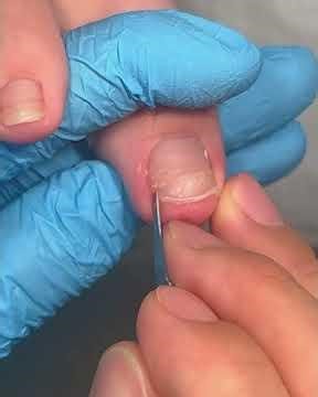 Gentle Toe Grooming | Fresh and Healthy Nail Look #toenailcare #pedicure #pedicureroutine #fypシ