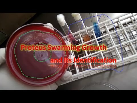 Proteus swarming growth on blood agar and its identification