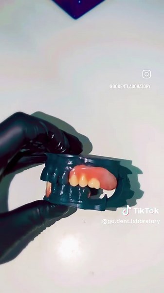 Perfectly Fitted Dentures for a Happy Smile