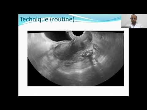 Technique for transvaginal ultrasound