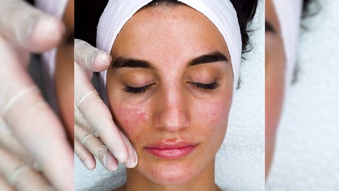 Transform You Skin With Masks