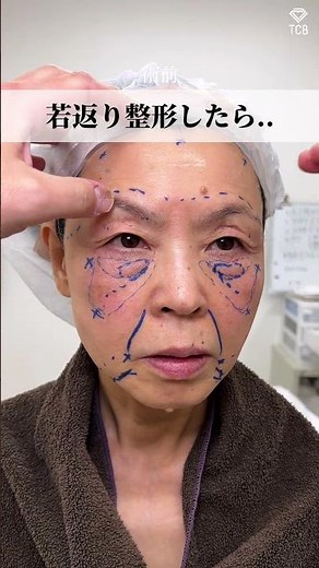 整形するとどうなる？