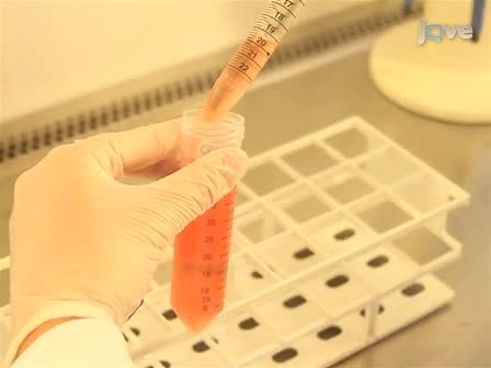 Isolation and Characterization of RNA-Containing Exosomes