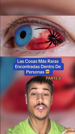 The Weirdest Things Found Inside People Part 8 🤯 #shorts