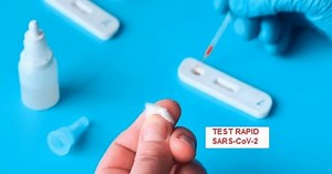 VIDEO Cum săîţi faci singur, acasă, testul rapid pentru coronavirusul SARS CoV2. „Fiecare virus lasă în organismul nostru urme”