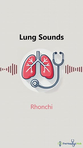 Rhonchi Lung Sounds Explained: Causes and Significance
