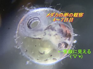 メダカの卵の観察 後編