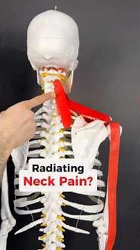 Radiating Neck Pain? Fix the Muscles under it all! #scalenes #neckpain #shoulderpain #armpain #neck