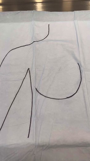 Breast implant sizing and how we choose the best implant to match your body and goals. Have a question? Drop it below! Call 212-680-4626 or visit my website for consultations. #plasticsurgery #plasticsurgeon #plasticsurgerytiktok #plasticsurgerycheck #breastaug #breastaugmentation #nycplasticsurgeon #nycplasticsurgery ##plasticsurgeonnyc##plasticsurgerynyc##fyp##foryou##foryoupage##GenshinImpact32##fakebody