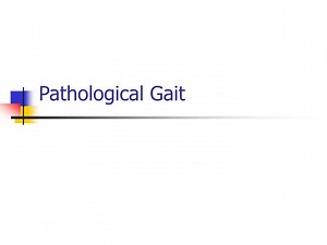 Pathological Gait - SlideServe