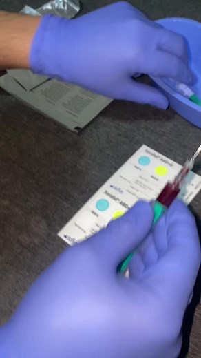 In partea de sus se determina grupa de sange a pacientului, iar in cea de jos grupa de sange din sangele care urmeaza a fi transfuzionat 😁 #emergencyblood #grupOAB