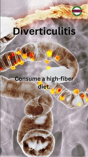 Diet For Diverticulitis
