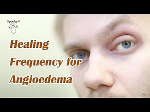 Healing Frequency for Angioedema - Spooky2 Rife Frequencies