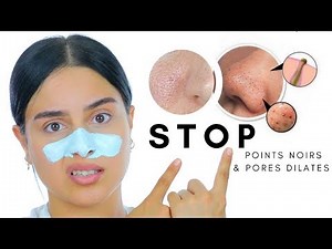 STOP AUX POINTS NOIRS & PORES DILATÉS