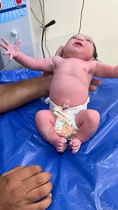 #baby moro reflex #baby born | اسلام الدح