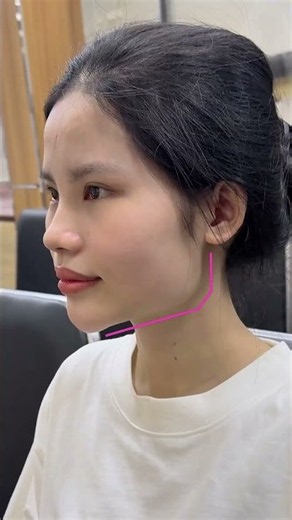 CHỈNH HÀM VUÔNG #drdoanlam