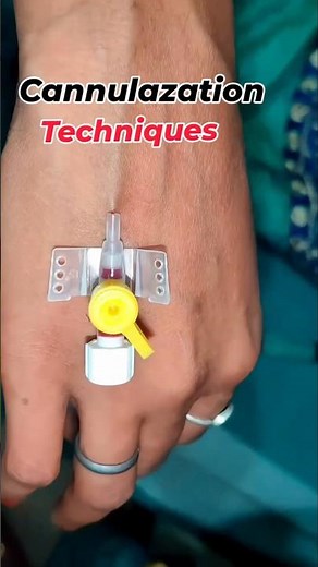 IV Cannulation Techniques Step by Step for Nurses & Students. #nursingstudent #nurse #cannula