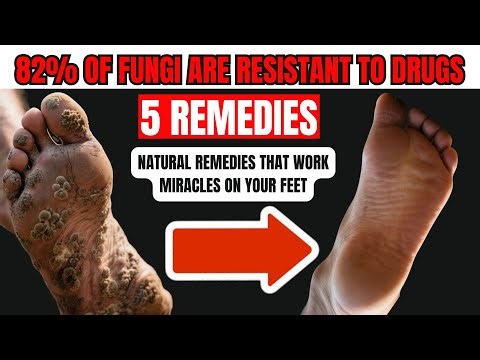 Cracked Heels? Rub THIS on Your Feet and They’ll Be Soft Again (5 Natural Remedies)