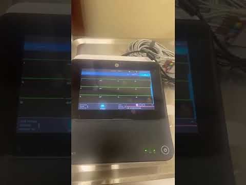 GE MAC 5 ECG Machine