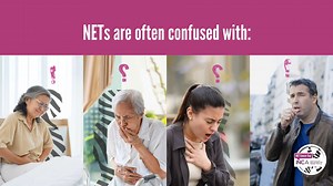 📣20 days to NET Cancer Day 2024! 🦓NET Cancer Day is on November 10th. Let’s get together and speak in one global voice about neuroendocrine cancer and the need for more awareness among healthcare professionals to help achieve early diagnosis. 👉This year we confirm again that neuroendocrine cancer is easily missed. It is easily disguised behind common symptoms. We need more healthcare professionals to know about it and consider it during diagnostics to save lives. ✔Let’s get ready to join effo