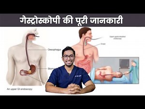 Is Gastroscopy Painful? Cost? Side Effects? Safety? Explained | Dr. Vishal Tomar | Open Consult