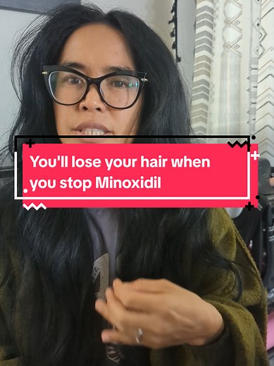 If you stop using Minoxidil, you won’t go bald overnight, but you will eventually lose all the progress you worked so hard for. Think of it as a daily management tool—like brushing your teeth—that keeps your hair in the growth phase longer than it wants to stay. For those of us with AGA, it is a lifelong commitment to keep the results. If you want the hair, you have to keep up the signal! #minoxidil #hairgrowthjourney #androgeneticalopecia #hairrestoration #consistency