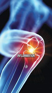 18K views · 363 reactions | Don't Put ICE On Your INJURIES! Here's Why... | Ken Berry | Facebook