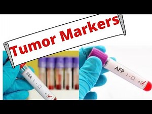 Tumour markers in cancer diagnosis/ Oncofetal Antigens