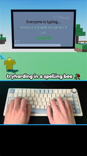 it's not that serious bro