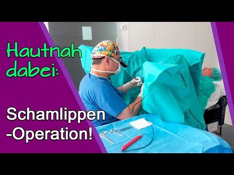 Up close: Intimate surgery for labia reduction – this is what it’s really like!