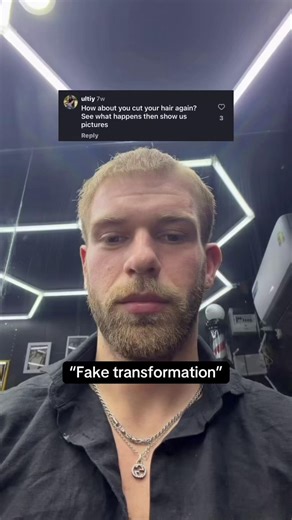 Don’t let anyone tell you it’s a fake transformation. Real results come from what’s happening at the follicle level. I skipped the expensive transplants and medications with scary side effects. Instead I focused on stimulating my scalp with micro needling. This natural approach combined with a topical DHT blocker made all the difference. It’s all about consistency. If you are early in your thinning journey just focus on the scalp.