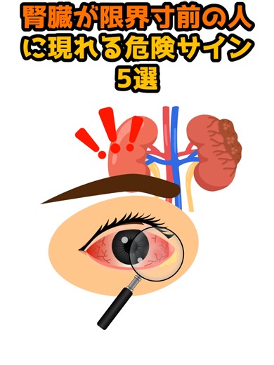 腎臓が悪い時に注意すべき5つの症状