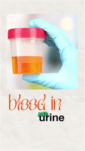 Kidney Stones Can Cause Severe Back Pain | Early Diagnosis & Treatment | Dr. Omang Agrawal