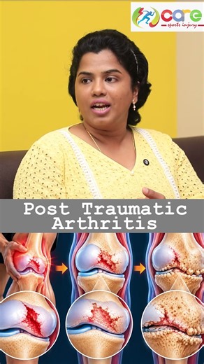 Post-Traumatic Arthritis: How an Old Injury Can Damage Your Joints