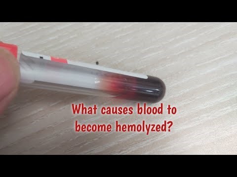 What causes blood to become hemolyzed?