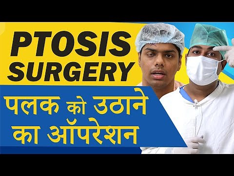 Ptosis (Droopy Eyelids) Treatment | Oculoplastic Surgery for Ptosis at Eye7 Eye Hospitals