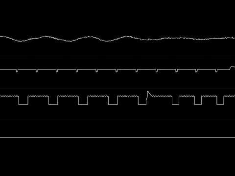 the army of angry penguins.xm