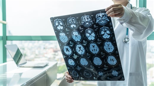 Why it's better to call a concussion a brain injury