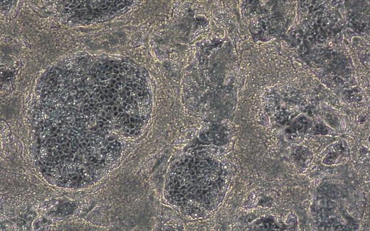 多能干细胞来源的跳动心肌