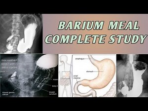 Barium Meal Complete Study Of Stomach