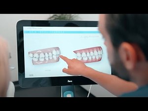 Dentist reviews the iTero Element™ 5D Plus scanner for restorative and orthodontic treatment