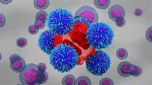 Study Finds CAR T-Cell Therapy Safe and Effective for Older Patients With B-Cell ALL