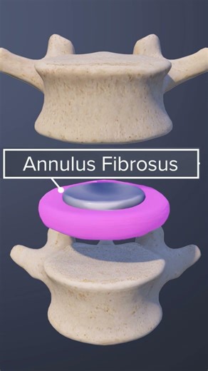 L4 - L5 Disc: 3D Animation of everything you need to know